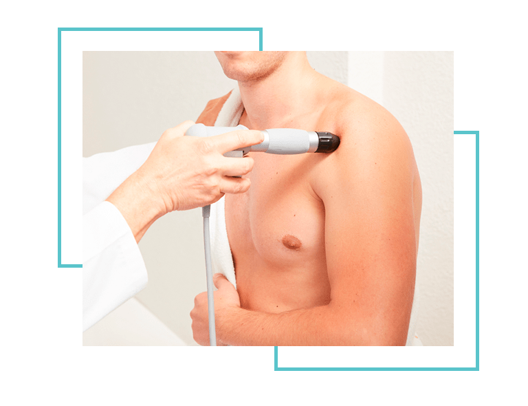 5 Exercícios para Tendinite no Ombro em Casa