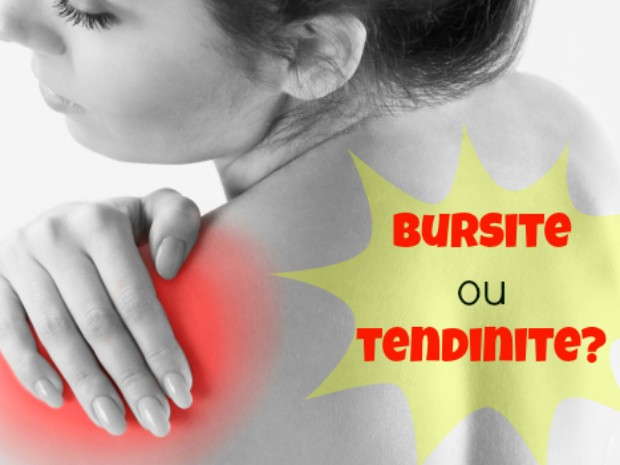 Guia Completo de Fisioterapia para Tendinite