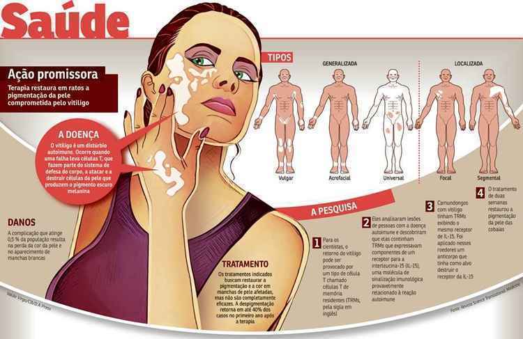 Os benefícios da fototerapia para o vitiligo