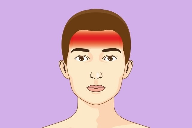 dores de cabeça na testa