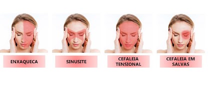 Sinusite e Dor Frontal: Como Identificar e Aliviar os Sintomas