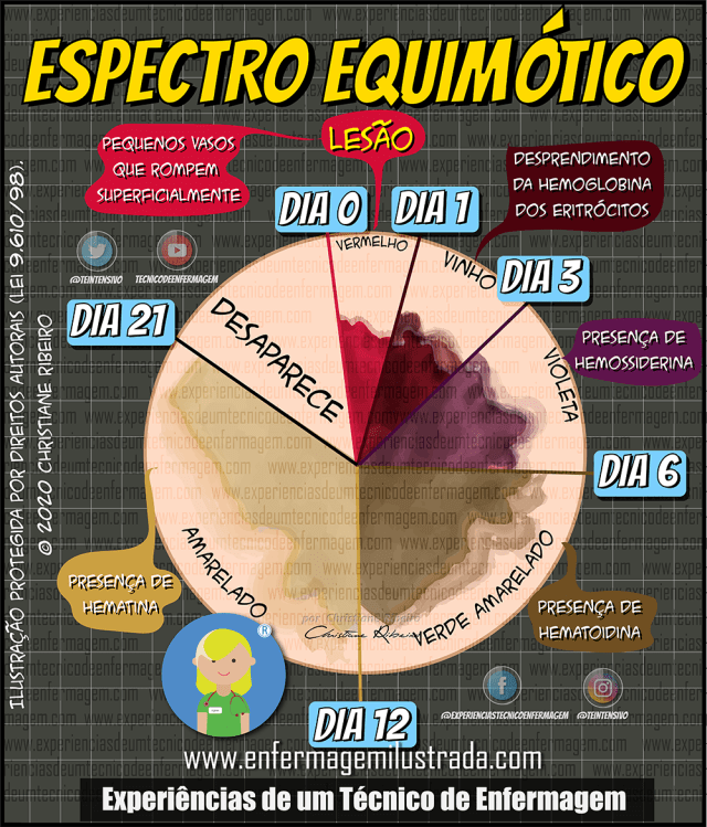 Como diferenciar equimose de hematoma: Guia completo
