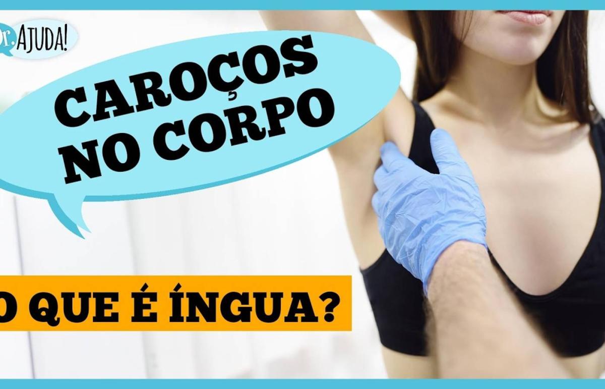 Como diferenciar íngua de hérnia inguinal