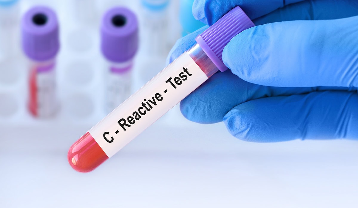 pcr proteina c reativa