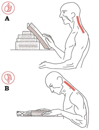Guia Completo: A Síndrome do Pescoço de Texto e Como Evitá-la